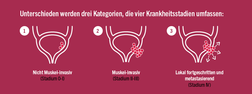 Drei Kategorien, vier Krankheitsstadien