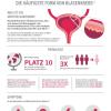 Urothelkarzinom - die häufigste Form von Blasenkrebs Factsheet