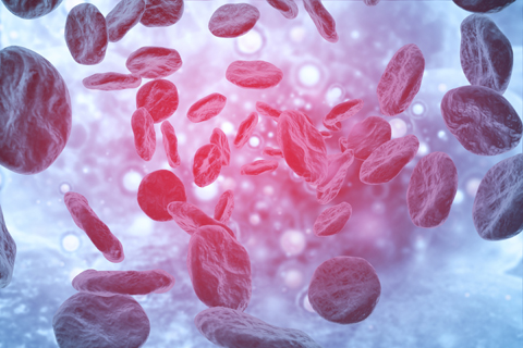 Acute Myeloid Leukaemia