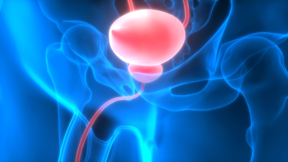 Bladder and urothelial cancer