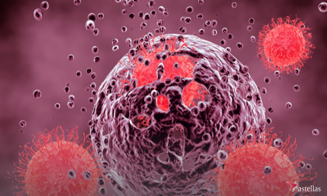 Cancro da próstata