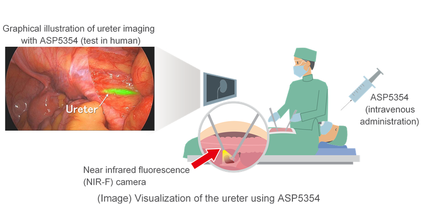 Visualization of the ureter using ASP5354