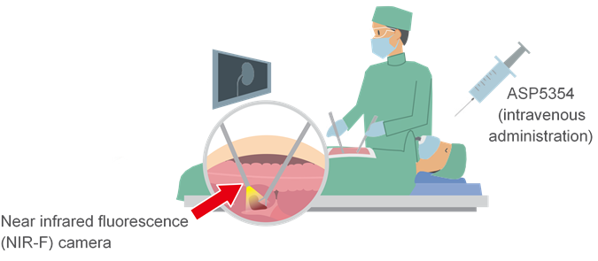 Investigational Near-Infrared Fluorescence Imaging Agent