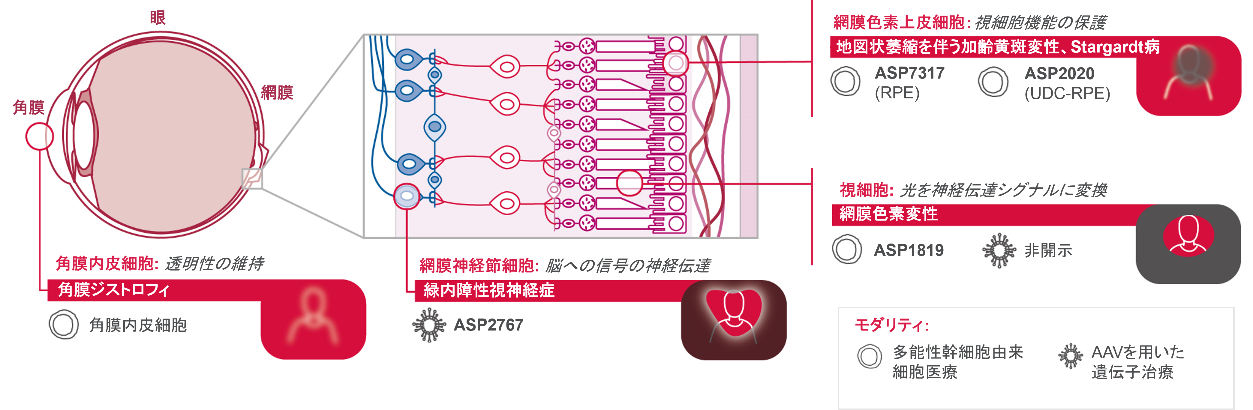 アプローチ